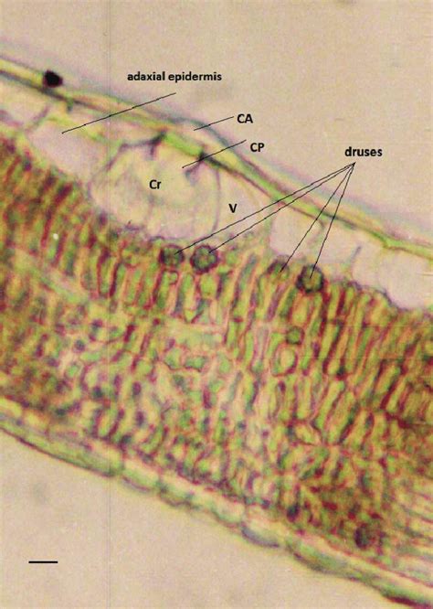 Morus alba L.-Kremikovtzi. Cystolith-containing idioblast: CA-cap... | Download Scientific Diagram