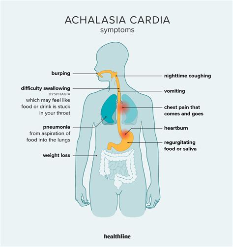 Achalasia Cardia: Symptoms, Causes, Treatment & Outlook