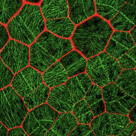 Microtubule self-organization, cell division, and the evolution of land plants | Department of ...