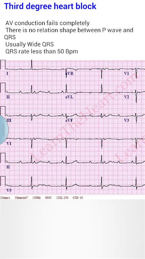 Practical Clinical Skills Ekg