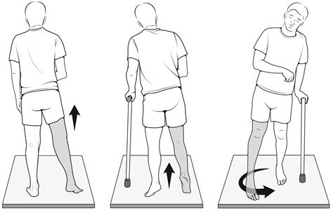 Hemiplegic Gait - Gait Training Exercise - Samarpan Physio