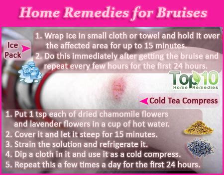 Home Remedies for Bruises | Top 10 Home Remedies