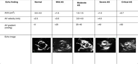 Grades Of Aortic Stenosis