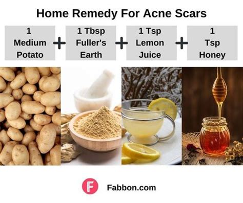 15 Most Effective Home Remedies For Acne Scars | Fabbon