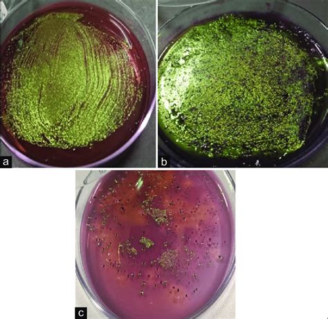 Results of sample culture on eosin methylene blue agar media; (a)feces ...