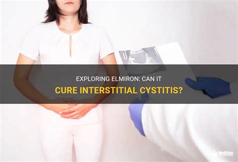 Exploring Elmiron: Can It Cure Interstitial Cystitis? | MedShun