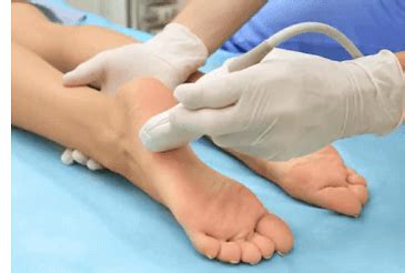 Treatment for Plantar Fibroma - Foot Pain Explored