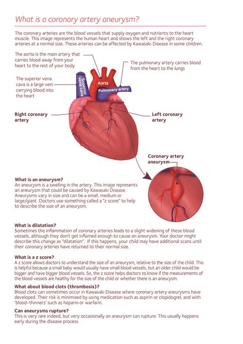 What is a coronary artery aneurysm - portrait-01 - Societi