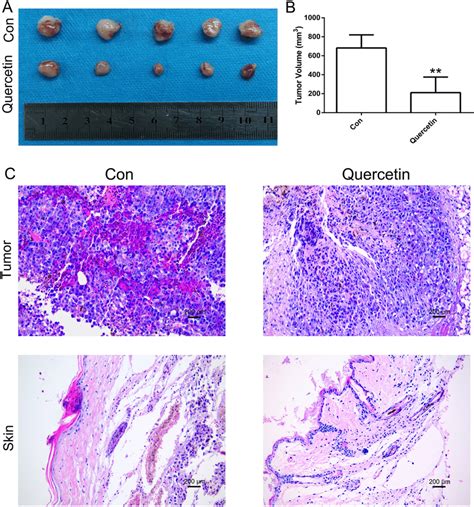 Morphological and histopathological assessment of tumor tissue. A ...