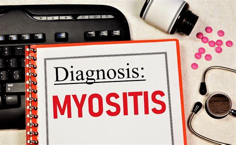 Symptoms of Myositis and How to Spot Them