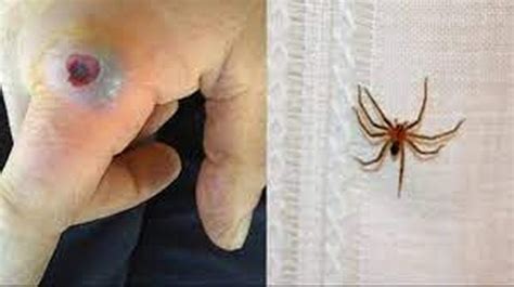 La picadura de la araña de rincón mató a dos personas: qué hacer y cómo reconocerla