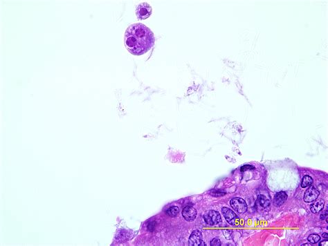 Sarcodines (Amoeba) // College of Veterinary Medicine