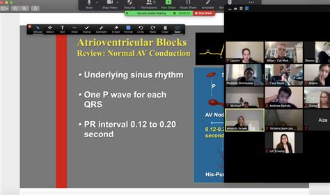 Certified EKG Tech Program - National Certification Virtual Class