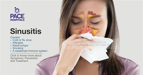 Sinusitis: Types, Causes, Symptoms and Treatment