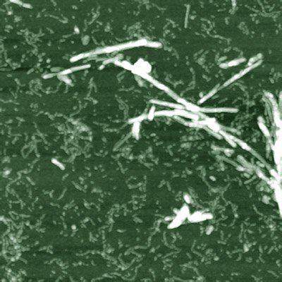 Beta 2 Microglobulin - Asylum Research Learning Centre