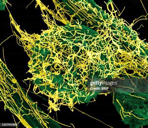 323 Ebola Microscope Stock Photos, High-Res Pictures, and Images - Getty Images