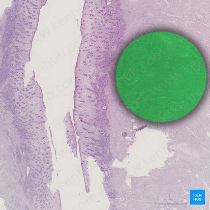 Myometrium: Histology and anatomy | Kenhub