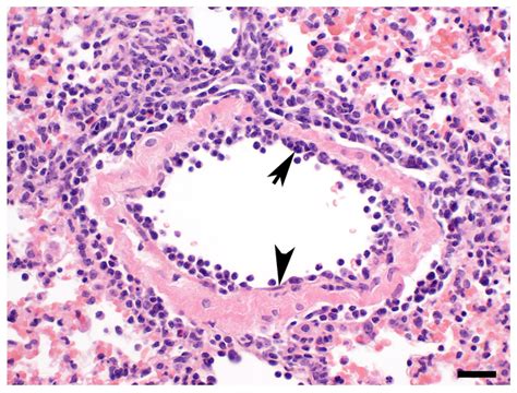 Endothelium [IMAGE] | EurekAlert! Science News Releases