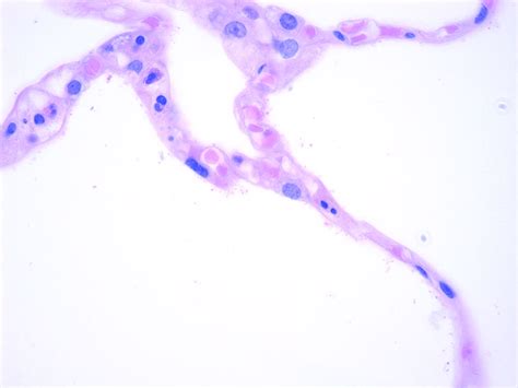 Pneumocytes