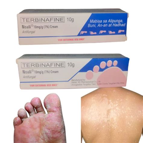 Terbinafine Anti-fungal Cream Effective for Buni, An-an, Hadhad and Alipunga 10g | Lazada PH