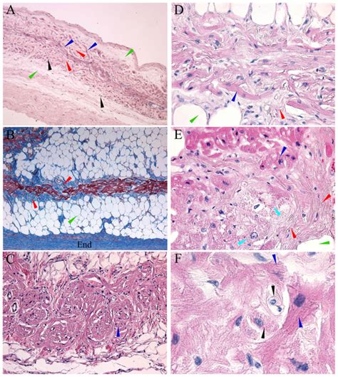 Interventricular Septum Histology