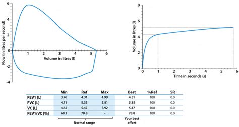 Spirometry test, spirometry results & spirometry interpretation