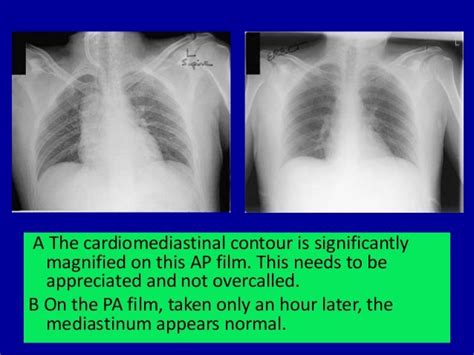 Basic radiology for non radiologist