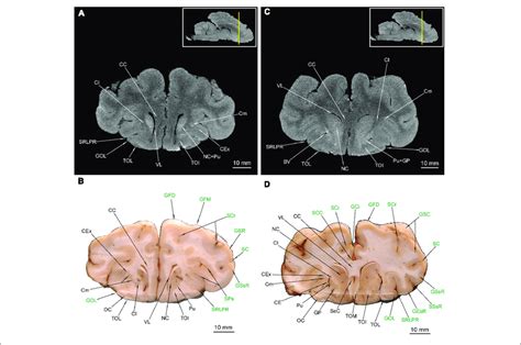 | MRI imaging and cross sections through the anterior part of... | Download Scientific Diagram