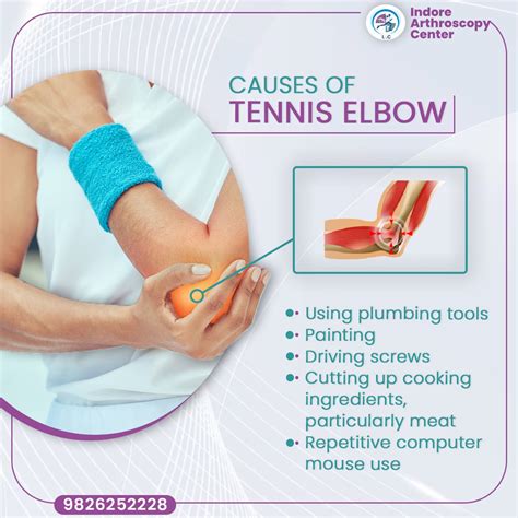 Causes Of Tennis Elbow | Sports Injury | Dr Manish Maheshwari | Tennis ...