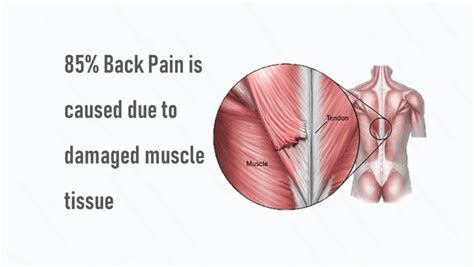 Lowering Blood Sugar: causes of upper back pain and numbness