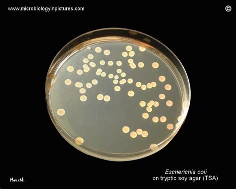 Petri dish with E.coli on triptic soy agar (TSA).