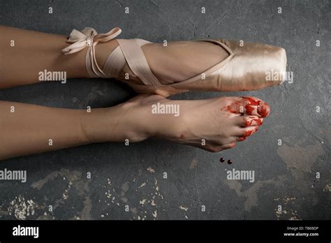 Damaged bloody legs of ballerina Stock Photo - Alamy