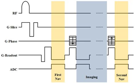 Pulse sequence diagram including two navigator echoes and imaging ...