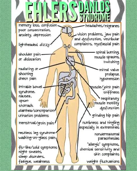 EDS symptom chart | Ehlers danlos syndrome, Ehlers danlos syndrome ...