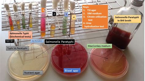 Salmonella: Introduction, Pathogenesis, Lab Diagnosis and treatment