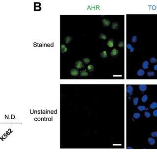 Gene and protein expression of aryl hydrocarbon receptor (AHR) in ...