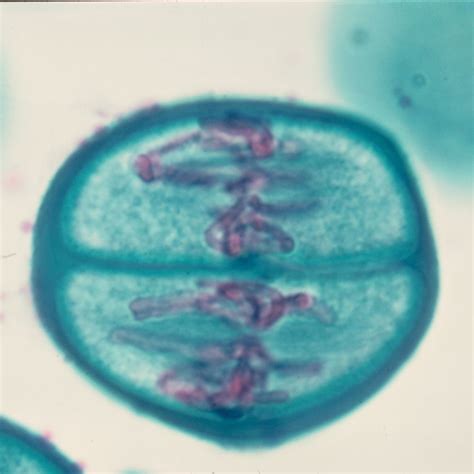prophase 2 lightmicroscopy - Google-søgning | Meiosis, Mitosis, Microscope slides