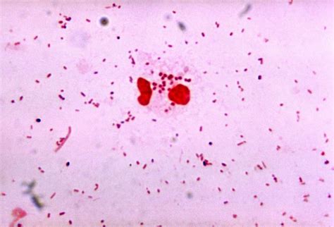 Neisseria Gram Stain