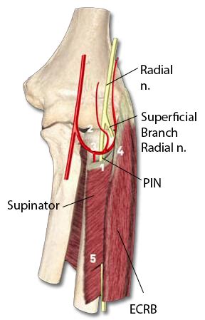 PIN Compression Syndrome - Hand - Orthobullets