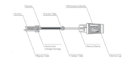 Angio-Seal™ VIP Vascular Closure Device