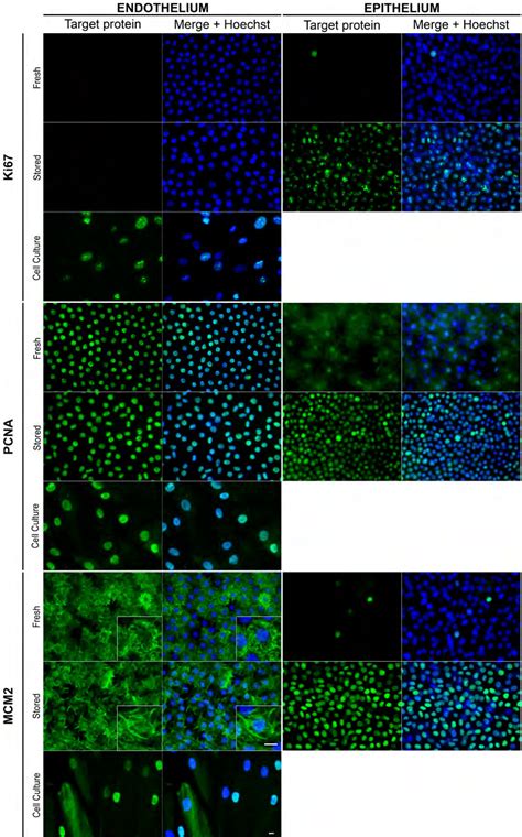 Optimized immunolocalization of proliferation markers in endothelial ...