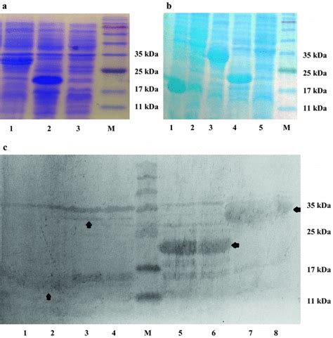 Analysis of the expression of different chimeric proteins. a Total cell... | Download Scientific ...