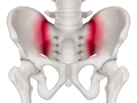 Sacroiliac Joint Dysfunction | Dr Yu Chao Lee