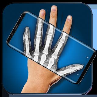 X-Ray Body Scanner Prank 1.7 screenshots viewer | AndroidAppsAPK.co