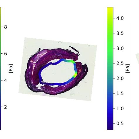 Histology images with WSS data projected onto the lumen. This figure ...