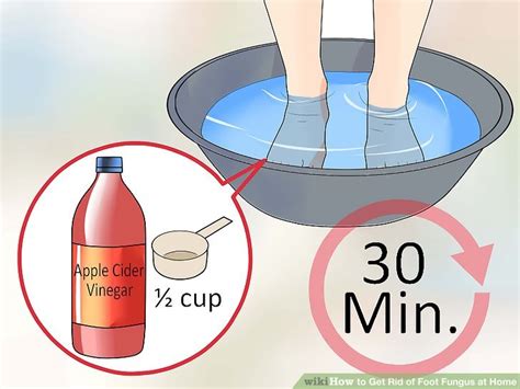 4 Ways to Get Rid of Foot Fungus at Home - wikiHow