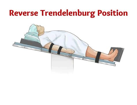 Reverse Trendelenburg Position |Complications |Indication |Benefits ...