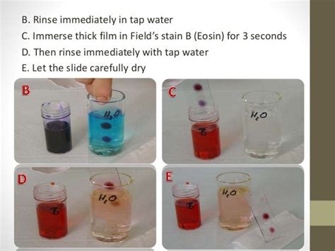 Blood smear staining