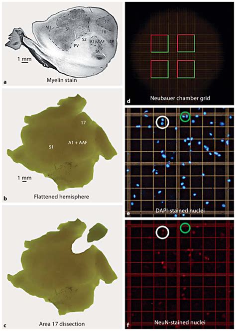 Methods of the isotropic fractionator process. a Flattened cortical ...