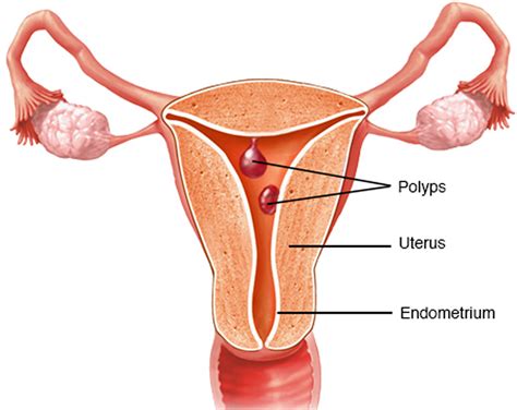 Menorrhagia, Premenopausal - Causes, Symptoms, Treatment